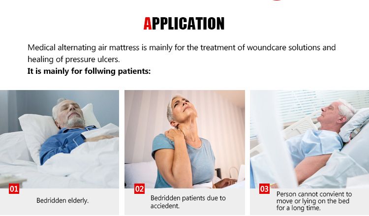 Hospital Low-Cost Anti-Decubitus Air Mattress